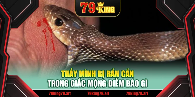 Thấy mình bị rắn cắn trong giấc mộng điềm báo gì Thấy mình bị rắn cắn trong giấc mộng điềm báo gì